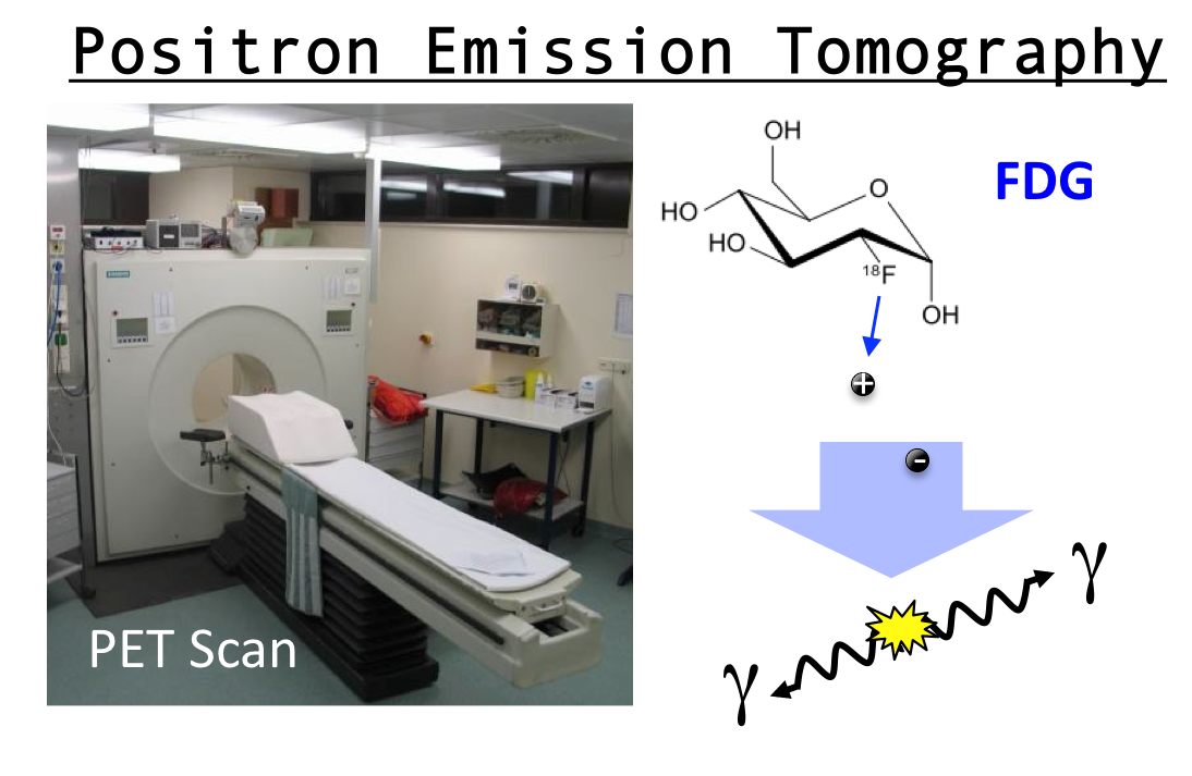 Antimatter practically in medical imaging....