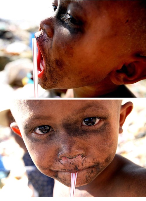 fycambodia:  See this little boy? Yes, he’s a little boy from Cambodia. Trying to have a nice drink of water. You can assume he’s poor and he doesn’t have clean water nor clean water to shower in. This little boy still seems to have a nice innocent