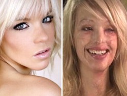 itsmeweasley:  sparkly-cupcakes:  danceifiwantto:  cheshirecat-smile:  dsfkjlbleeh:   I think all girls should read this. This is Katie Piper, a model. MY IDOL. She’s 25 now, and in 2008. she started dating Daniel Lynch. After two weeks, Lynch started