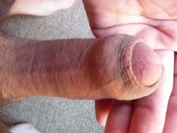 this is my recreated foreskin by stretching, i love having skin back 