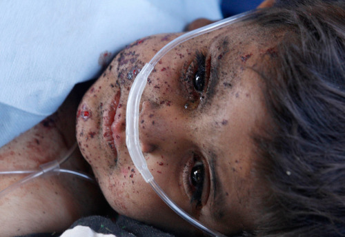 A child receives medical attention during a Medevac mission in southern Afghanistan’s Helmand province November 13, 2010. The child was injured in an explosion. (REUTERS/Peter Andrews)