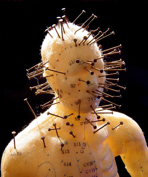 Acupunctureby John E Fortune, MD