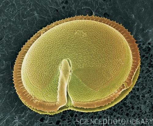 Identified as Prorocentrum gambierdiscus by original source; identified as Diplopsalis or Zygabikodinium by Dean Jacobson.
“  Coloured scanning electron micrograph (SEM) of the dinoflagellate, Prorocentrum gambierdiscus. Prorocentrum species produce...