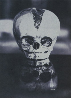 Infant’s Skull with Open Fontanelle unidentified