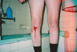 lucindaevamay:My Bloody Knee, 2011