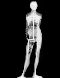 hydeordie:  Edgar Degas Little Dancer Aged Fourteen, 1878-1881,  radiograph, overall frontal view.  