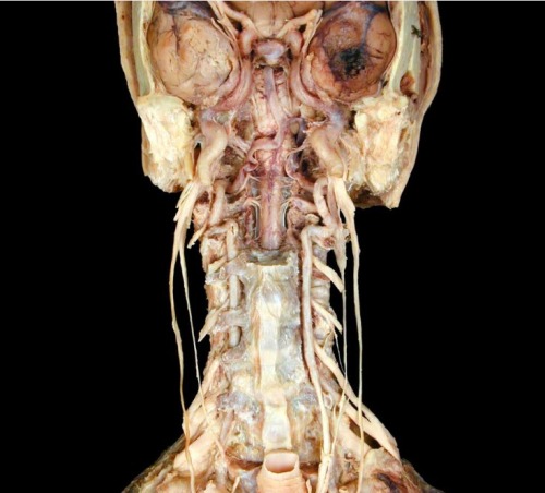 fuckyeahnervoussystem:  Internal carotid and vertebral arteries - anterior view