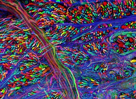 starhammer:  The ‘Brainbow’ technique is used to map the neuron network within a transgenic specimen by combining fluorescent proteins to create an entire colour palette.