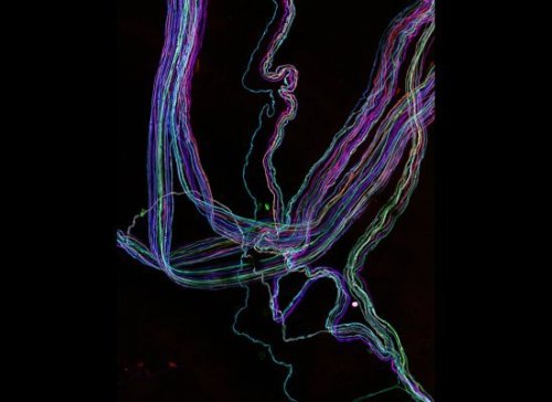 starhammer:  The ‘Brainbow’ technique is used to map the neuron network within a transgenic specimen by combining fluorescent proteins to create an entire colour palette.