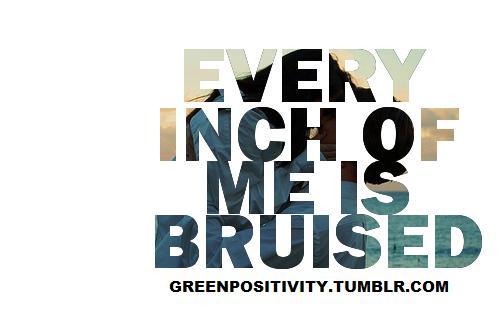 greenpositivity:  bruised - jacks mannequin this is a special one;