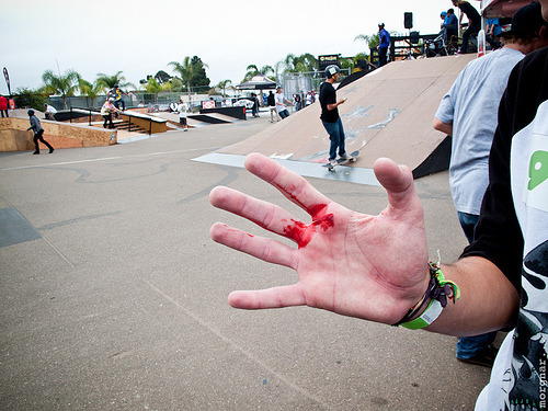 methology:  GORE BLOG 2K11’ 