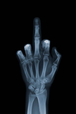 artchipel:  Nick Veasey -The Finger. C-Type