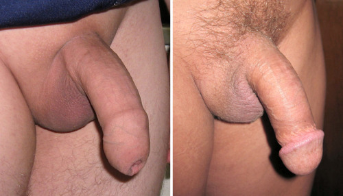 Erect uncircumcised penis foreskin