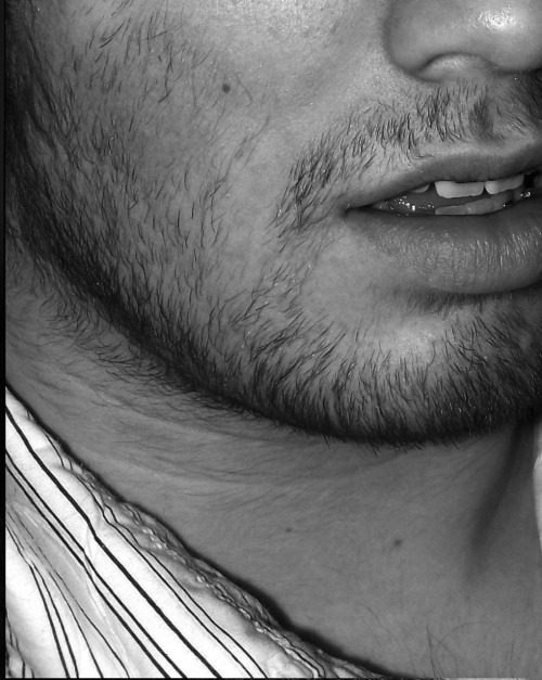 bloominglights:I like my beard.
