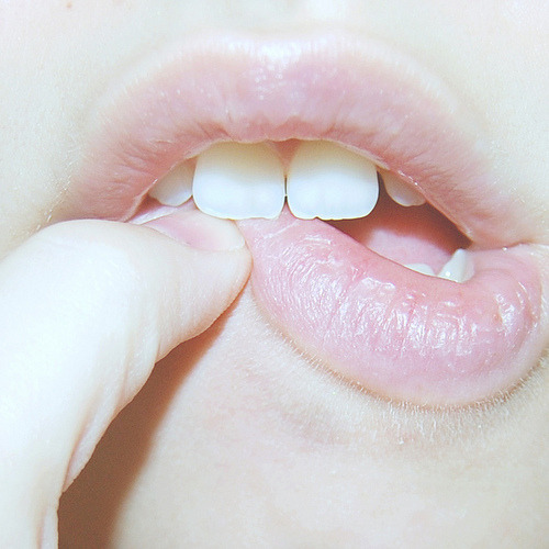 porcelaineskulls:  this is how I gained thousands of followers ♡ click here for soft grunge/models/fashion ♡