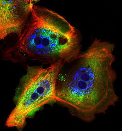 livewithpassion3:  Hepatocytes.