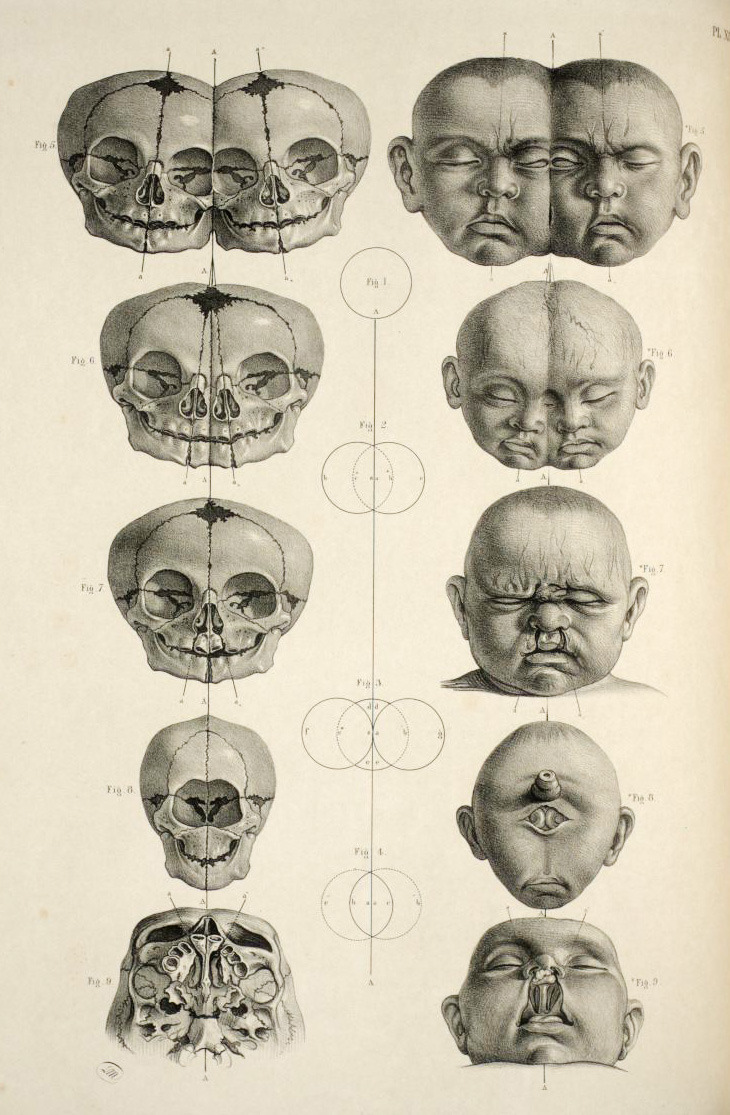 fiveoclockbot:  Morbid Anatomy I 