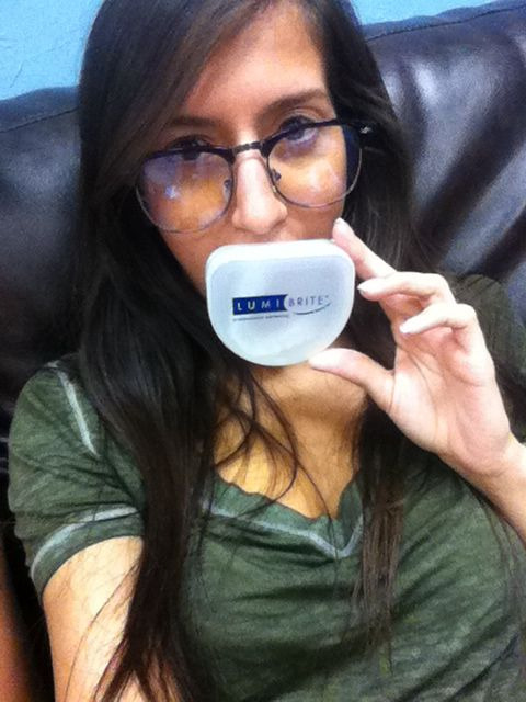 Teeth whitening!