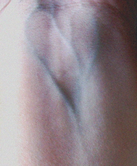 Little Shadow