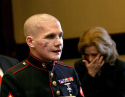 rimez:   The beautiful face of courage: Lance Cpl. William Kyle Carpenter USMC Carpenter, 21, of Gilbert lost the eye, most of his teeth and use of his right arm from a grenade blast Nov. 21 near Marjah, Helmand Province, Afghanistan.Friends and family