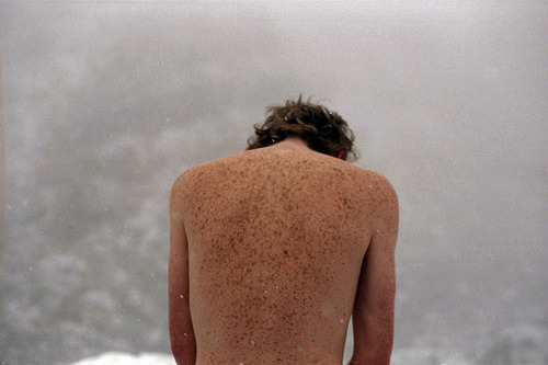 igaer:Snow Freckles. (by Sophia Jenny-Lee)