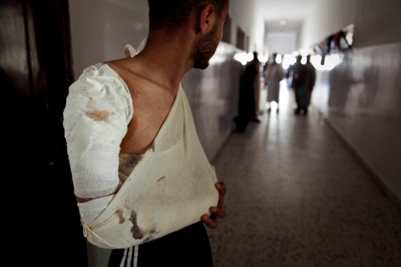 A wounded prisoner-of-war inside a rebel-run camp in Misrata, Libya.