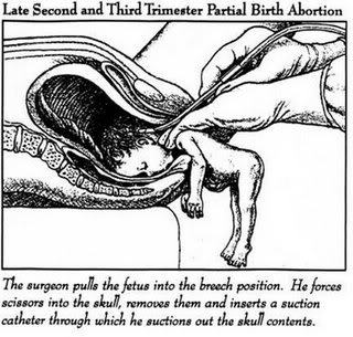 miss-love:
“ stfuconservatives:
“ accordingtosami:
“ stfufauxminists:
“ pansymandy:
“ This practically made me cry. How could this ever be okay?
”
[Image: An illustration is labeled as a “partial birth abortion”. It shows a person performing an...