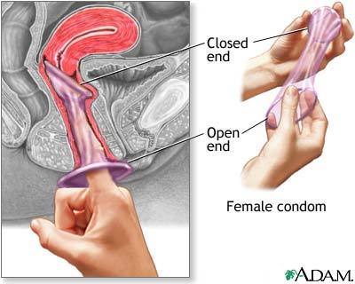 Female condom sex