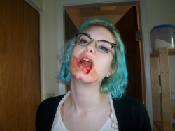 killyourinspiration:  Me, right after my surgery on Thursday morning.  I had my four wisdom teeth taken out.  Still gorgeous, tbh. However, this makes me insanely nervous about possibly getting my wisdom teeth removed.