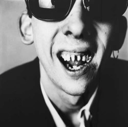 Shane Patrick Lysaght MacGowan is a musician and singer, best known as the original singer and songwriter of The Pogues.