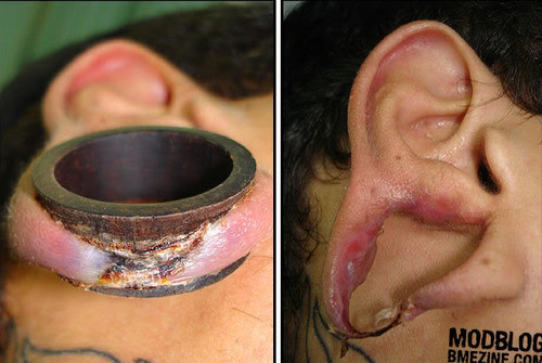 youthwanted:  bearbaskets:  i-want-a-wombat:  Not my ear, but still worth showing.  oh… oh god.  Omgomgomg, eeeeew…   Ewwwwieeee