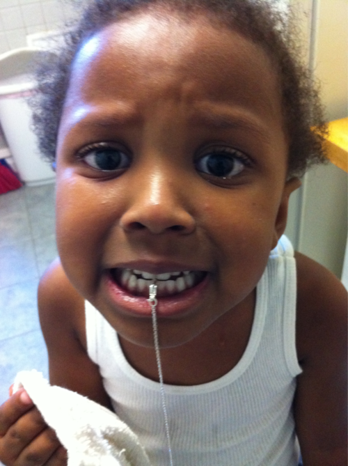 The joys of parenting. This girl got the clasp of the chain between her teeth! It