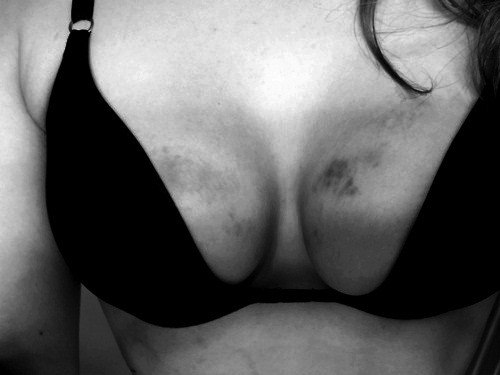 fuckkkyoumydarling.tumblr.com/post/25173797012/