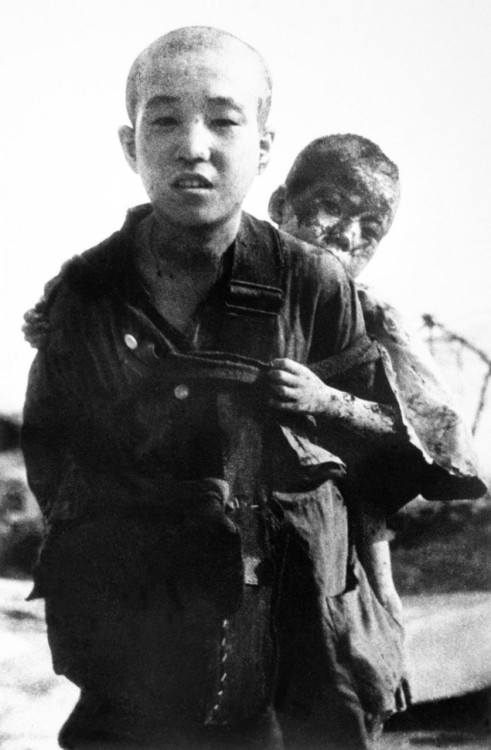 hitlerjunge-salomon:  The boy that is on the back is his brother, received burns on 10 August 1945 in Nagasaki, Japan. These pictures are not made public by the Japanese side, but after the war, they were shown to the world’s  mass media by UN. 