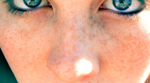 thehottestgoddess: Pretty eyes! Nice dusting of freckles ! heyitslolo: MA FACE