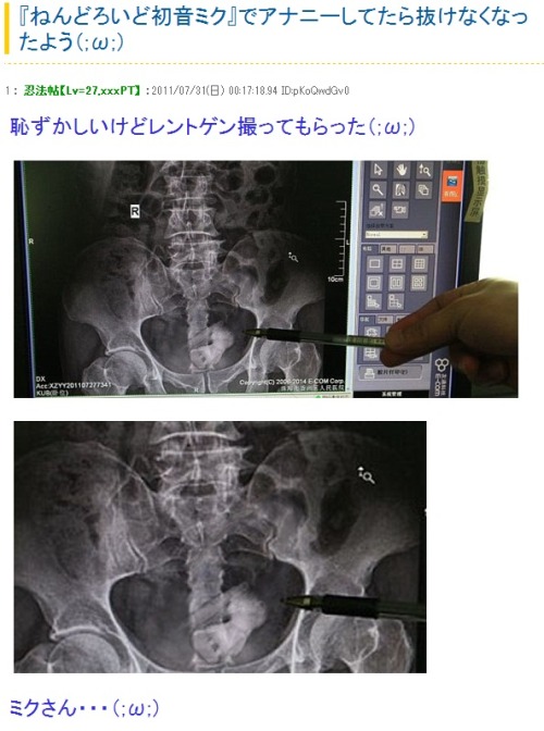 yomyomyom:  on 2chan.net [ExRare]