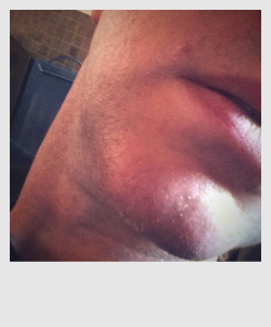 forksmistyrain:  anyminorworld:  I fought the razor and the razor won. (Mostly.)  Hmmm.. can I kiss it better? 