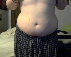 fuckyeahchubbygirls:  I am super self conscious about my stretch marks. Very few of my friends know about them. I hate them so much, they’re so embarrassing. They are definitely what I hate the most on my body.  Awww, stretch marks are cute!