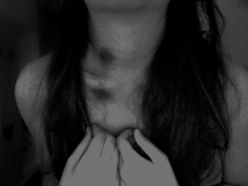  anthrodynia 