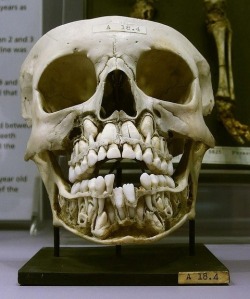 jtotheizzoe:   The creepiest thing I will see all day … We all know that children lose their baby teeth over the course of several years, and they are replaced by adult chompers. With that in mind, here it is: The skull of a child with adult teeth coming