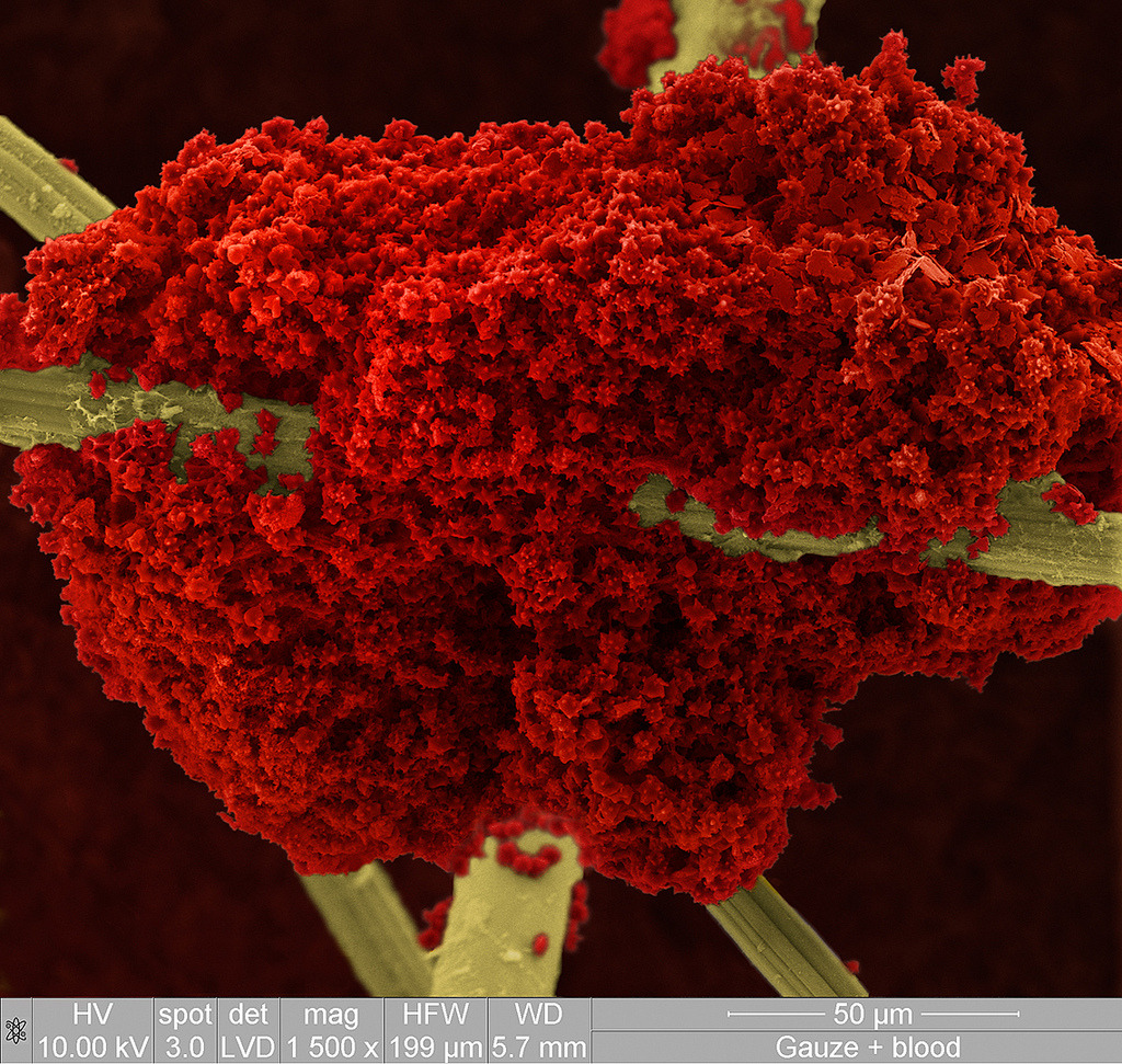 gothiccharmschool:  Blood drying on cotton gauze fibers, magnified. 