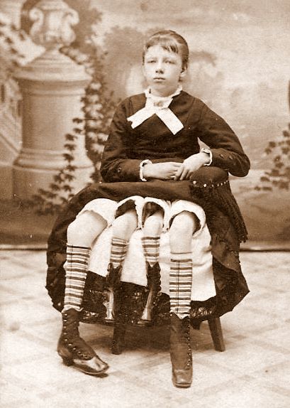 Myrtle Corbin of Tennessee, who was born in 1868 with four legs.