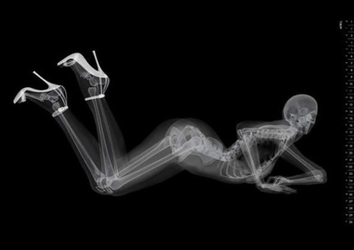 zeroing:  x-ray pin-up calendar 