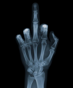 ohthentic:  authentic-boredom:X-Ray This