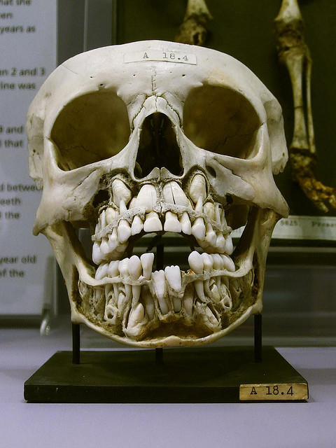 ilovebender:  (via Child?s Skull Showing Both Baby and Adult Teeth) 