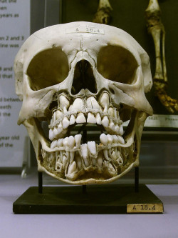 ilovebender:  (via Child?s Skull Showing Both Baby and Adult Teeth) 