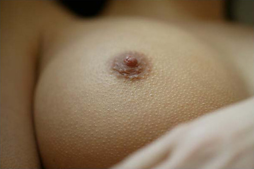 XXX breast photo