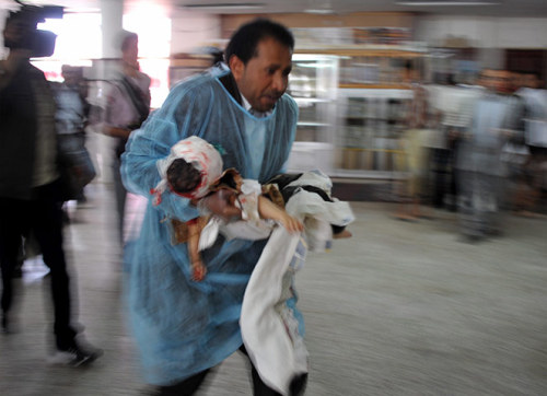 Sana'a, Yemen: A doctor carries a wounded child in a field hospital following assaults against prote