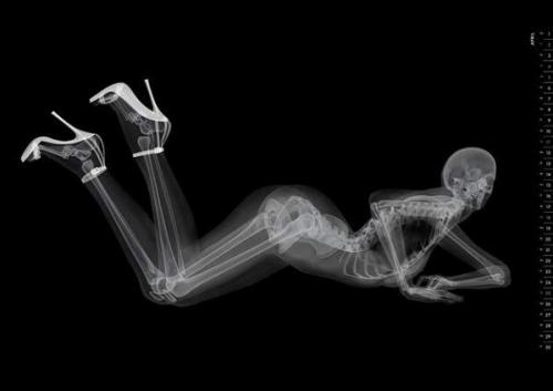 metaconscious:  Eizo, a manufacturer of medical imaging equipment, has released a revealing new calendar to promote their wares.  The Eizo X-Ray Pin-Up Calendar is at once hilarious and inventive, a most creative way of promoting their brand to their