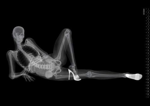 metaconscious:  Eizo, a manufacturer of medical imaging equipment, has released a revealing new calendar to promote their wares.  The Eizo X-Ray Pin-Up Calendar is at once hilarious and inventive, a most creative way of promoting their brand to their